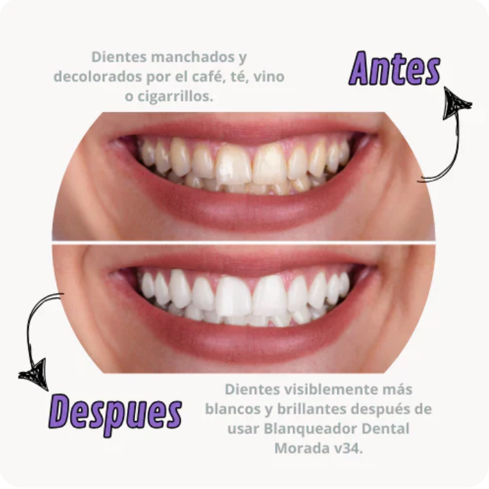 Dientes Más Blancos Al Instante - MILOHA v34