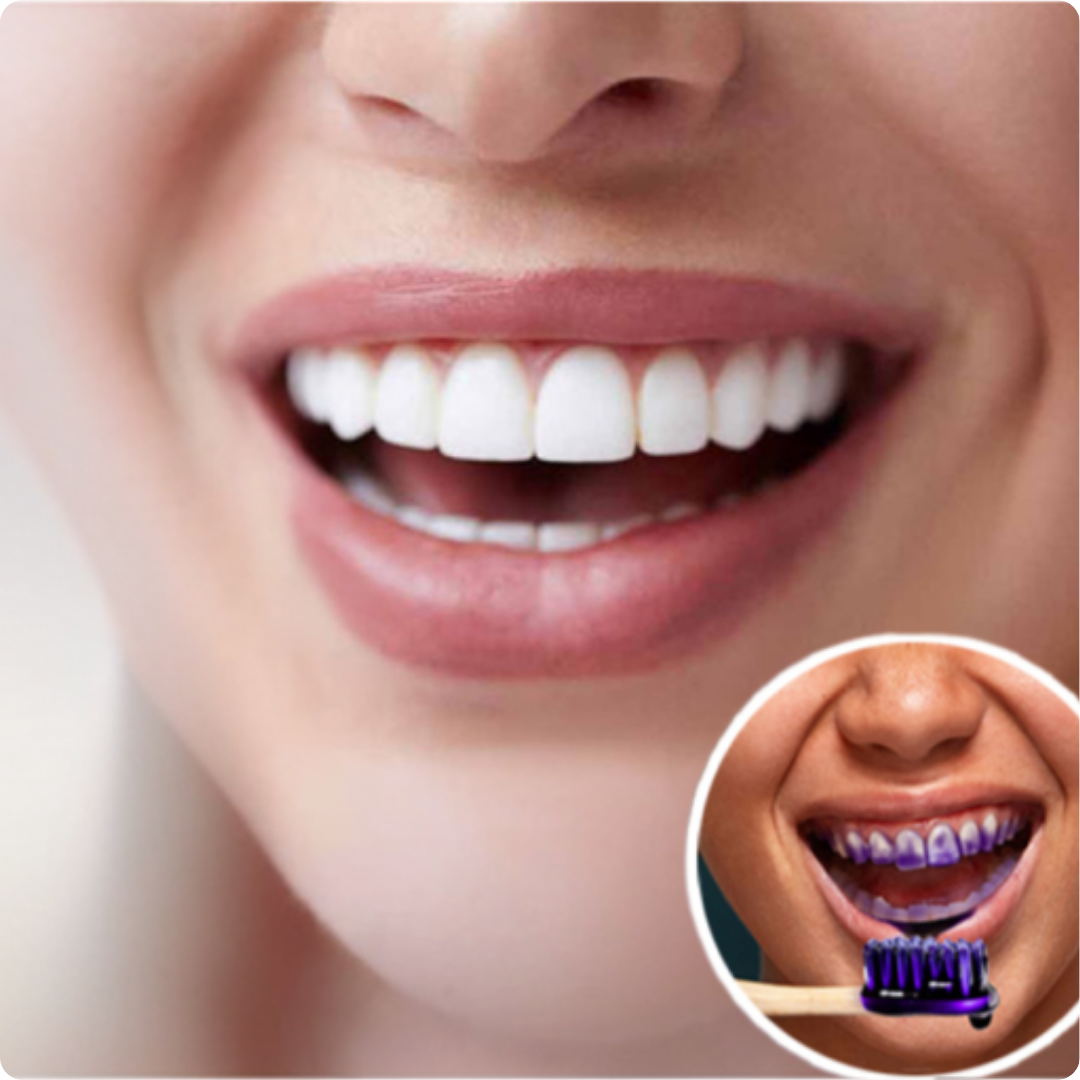 Dientes Más Blancos Al Instante - MILOHA v34