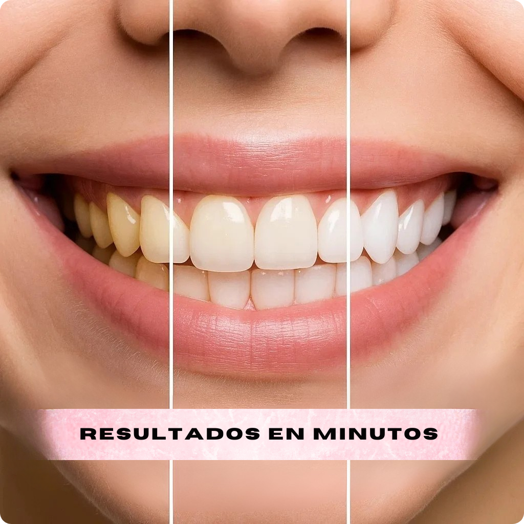 Dientes Más Blancos Al Instante - MILOHA v34
