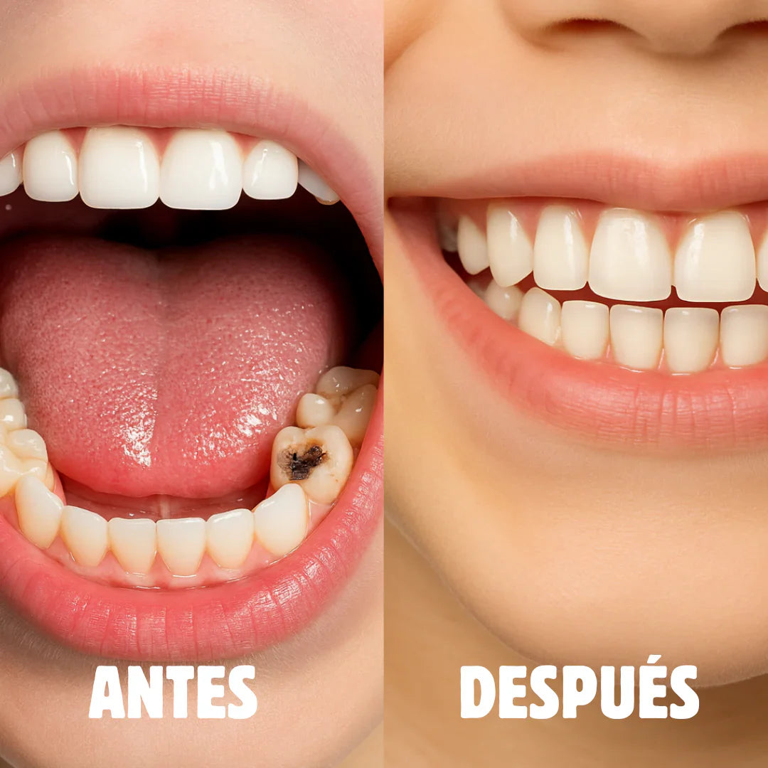 Cepillo Anticaries Infantil SUNNYSMILE™ PRO