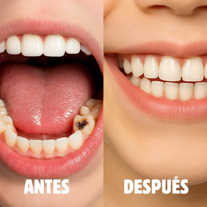 Cepillo Anticaries Infantil SUNNYSMILE™ PRO