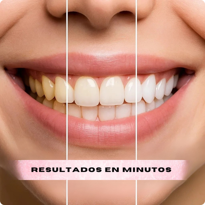 Dientes Más Blancos Al Instante - MILOHA v34